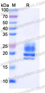 Recombinant Human COQ7 Protein, C-His
