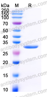 Recombinant Human TPK1 Protein, C-His