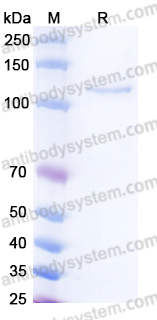 Recombinant Human NRCAM Protein, C-Fc