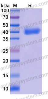 Recombinant Human KLK5 Protein, C-His