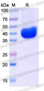 Recombinant Human MECR Protein, C-His
