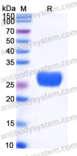 Recombinant Human ULBP1 Protein, C-His