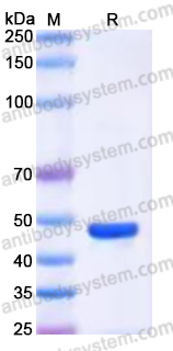 Recombinant Human NTNG1/Netrin-G1 Protein, C-His