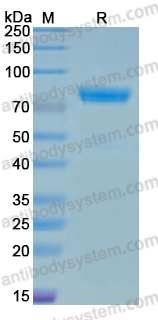 Recombinant Human NTNG1/Netrin-G1 Protein, C-mFc