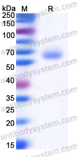 Recombinant Human ANTXR1/TEM8 Protein, C-His