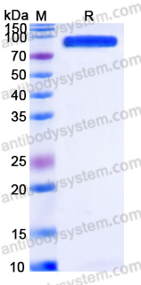 Recombinant Human PACSIN2 Protein, C-His