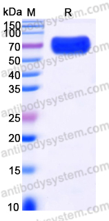 Recombinant Human RTN4R/NgR1/Nogor Protein, C-His