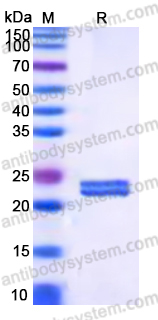 Recombinant Human ST6GALNAC2/SIAT7-B Protein, C-His