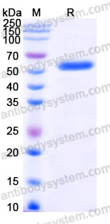 Recombinant Human HLA-A*0201 WT-1 Complex Protein, C-10*His