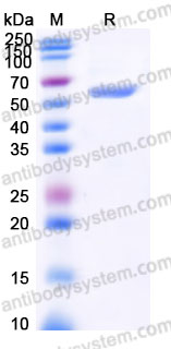 Recombinant Human HLA-A*0201 TP53 Complex Protein, C-10*His
