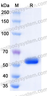 Recombinant Human HLA-A*0201 AFP Complex Protein, C-10*His (Active)