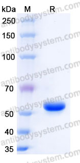 Recombinant Human HLA-A*0201 Survivin Complex Protein, C-10*His (Active)