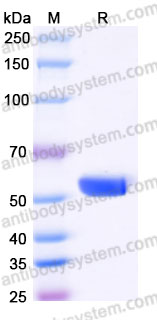 Recombinant Human HLA-A*0201 GPC3 Complex Protein, C-10*His (Active)