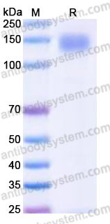 Recombinant Human SEZ6L2 Protein, C-9*His