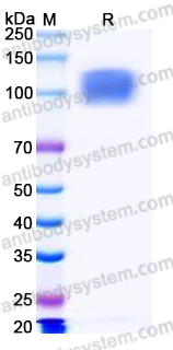 Recombinant Human ROBO4 Protein, C-Fc