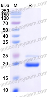 Recombinant Human PRAP1/uPA Protein, C-His