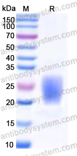 Recombinant Human PRND Protein, C-His