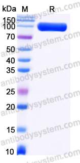 Recombinant Human NLGN1 Protein, C-His