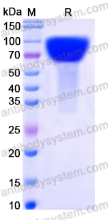 Recombinant Human FLRT3 Protein, C-His