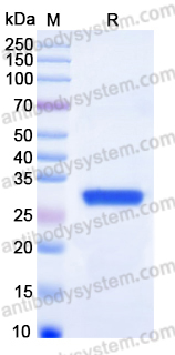 Recombinant Human COLEC11 Protein, C-His