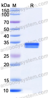 Recombinant Human VSIG2 Protein, C-His