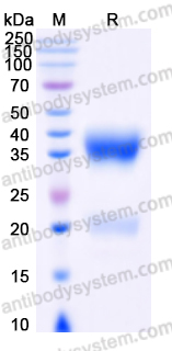 Recombinant Human VSTM2A Protein, C-His