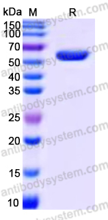 Recombinant Human TINAGL1 Protein, C-His