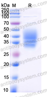 Recombinant Human CLEC4E Protein, C-His