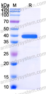 Recombinant Human ITPRIPL1 Protein, C-Fc