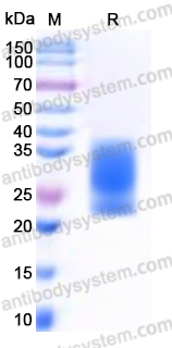 Recombinant Human PIK3IP1 Protein, C-His