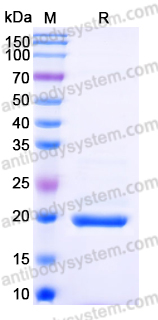 Recombinant Human SECTM1 Protein, C-His