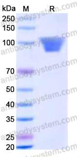 Recombinant Human NLGN4X Protein, C-His