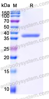 Recombinant Human CTRC Protein, C-His