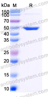 Recombinant Human WIF1 Protein, C-His
