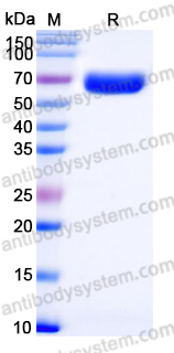 Recombinant Human RTN4RL1 Protein, C-His