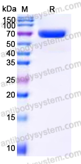 Recombinant Human CFHR5 Protein, C-His