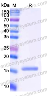 Recombinant Human IGLC2 Protein, C-His