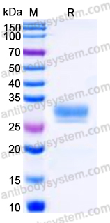 Recombinant Human ULBP2 Protein, C-His