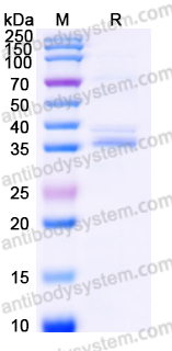 Recombinant Human TREML2 Protein, C-Fc