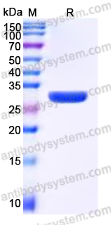 Recombinant Human HDGFL3 Protein, C-His