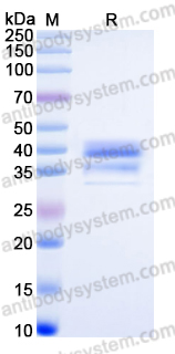 Recombinant Human CGREF1 Protein, C-His