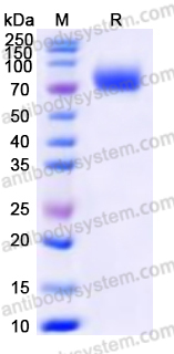Recombinant Human PLXDC1 Protein, C-His