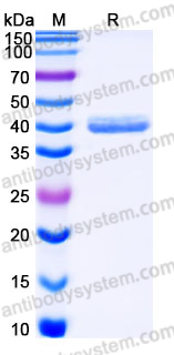 Recombinant Human CRELD2 Protein, C-His