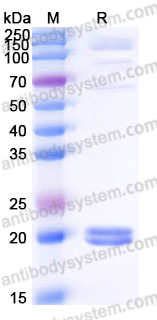 Recombinant Human VMO1 Protein, C-His