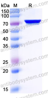 Recombinant Human GALNT7 Protein, C-His