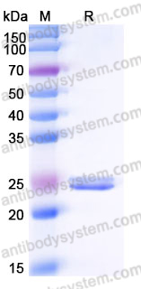 Recombinant Human LYG2 Protein, C-His