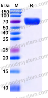 Recombinant Human TMPRSS11B Protein, C-His