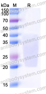 Recombinant Human LRRC25 Protein, C-His
