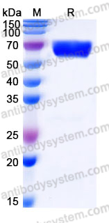 Recombinant Human GALNT16 Protein, C-His