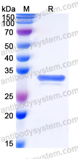 Recombinant Human PARP16 Protein, C-His